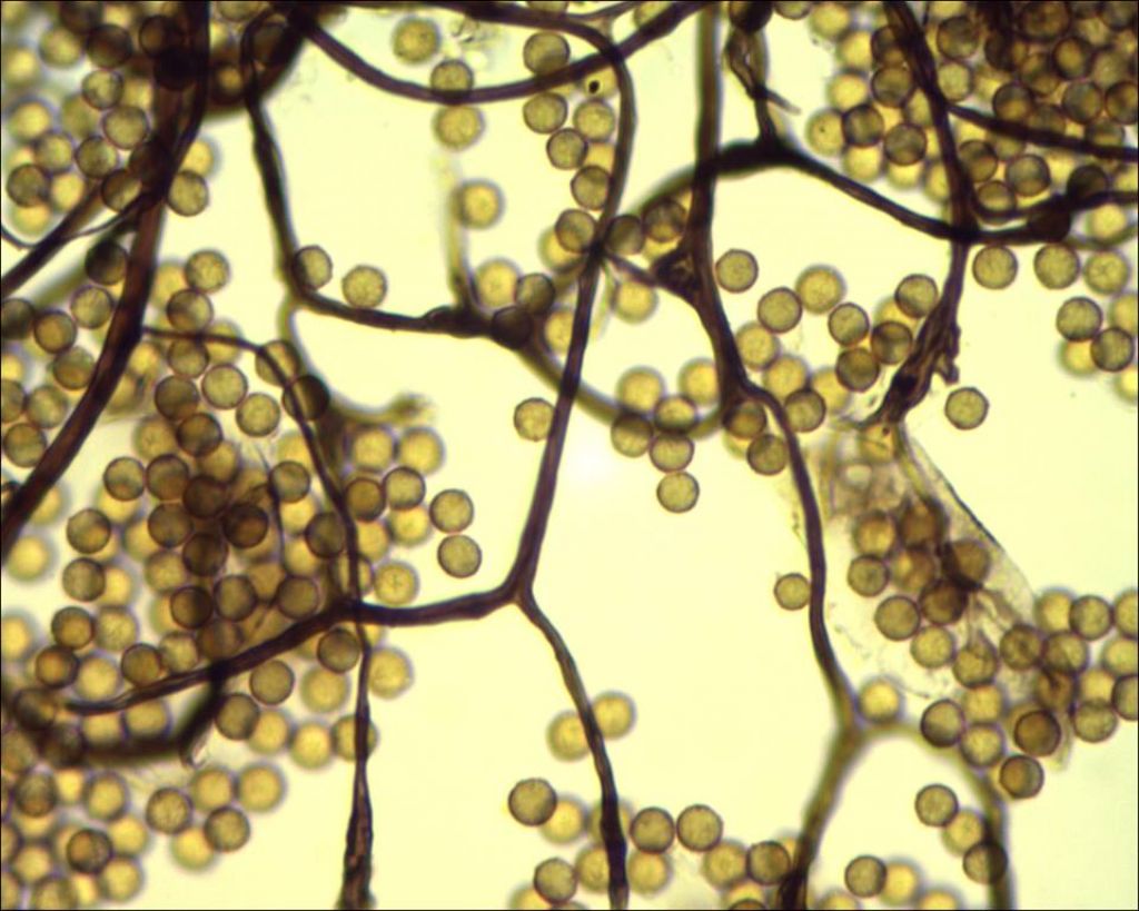 Comatricha o Stemonitopsis?